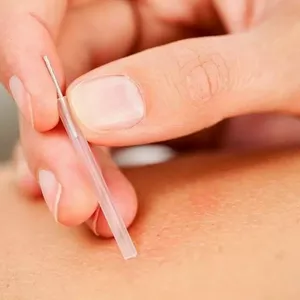 Imagem de capa para o Evento presencial Z Curso de Dry Needling, Eletro Dry Needling e Magnetoterapia - Agulhamento na Dor, 26 e 27 de Junho de 2021, Sábado e Domingo, 08h ás 18h