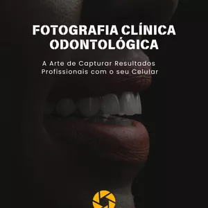 Imagem de capa para o Ebook  FOTOGRAFIA CLÍNICA  ODONTOLÓGICA   A Arte de Capturar Resultados  Profissionais com o seu Celular