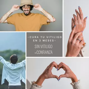 Imagen de portada para Ebook Cura Tu Vitiligo En 3 Meses