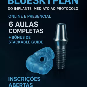 Imagem do curso Planejamento e confecção de guias cirúrgicas com o blueskyplan