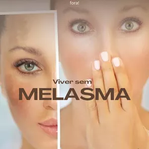 Imagem de capa para o Ebook VIVER SEM MELASMA