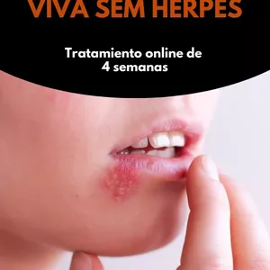 Imagen de portada para Ebook Viva Sem Herpes