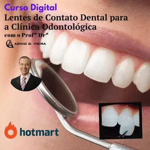 Curso Digital - Lentes de Contato Dental para a Clínica Odontológica