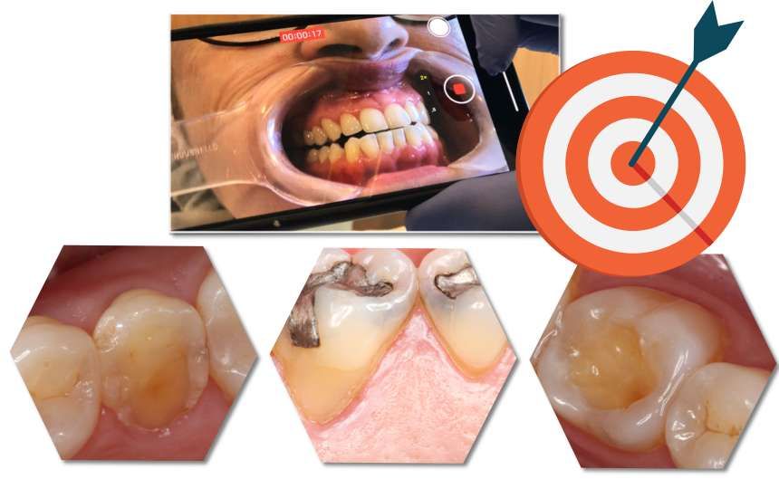 envelhecimento precoce