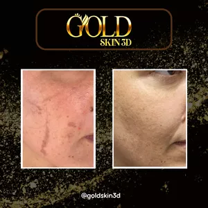 Imagem de capa para o Curso online PROTOCOLO GOLD SKIN 3D