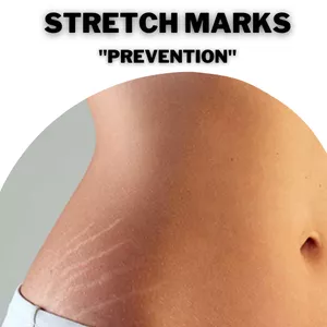 Cover image for Ebook Stretch Marks Prevention