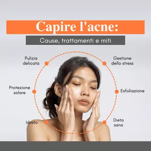 Cover image for Online course Capire l'acne: cause, trattamenti e miti