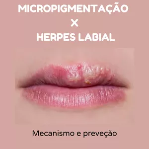 Imagem de capa para o Ebook Herpes labial X Micropigmentação