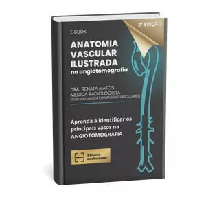 Imagem do curso Anatomia Vascular no estudo de Angiotomografia. E-book ilustrado.