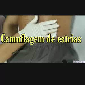 Imagem de capa para o Curso online Camuflagem de estrias 3 técnicas exclusivas