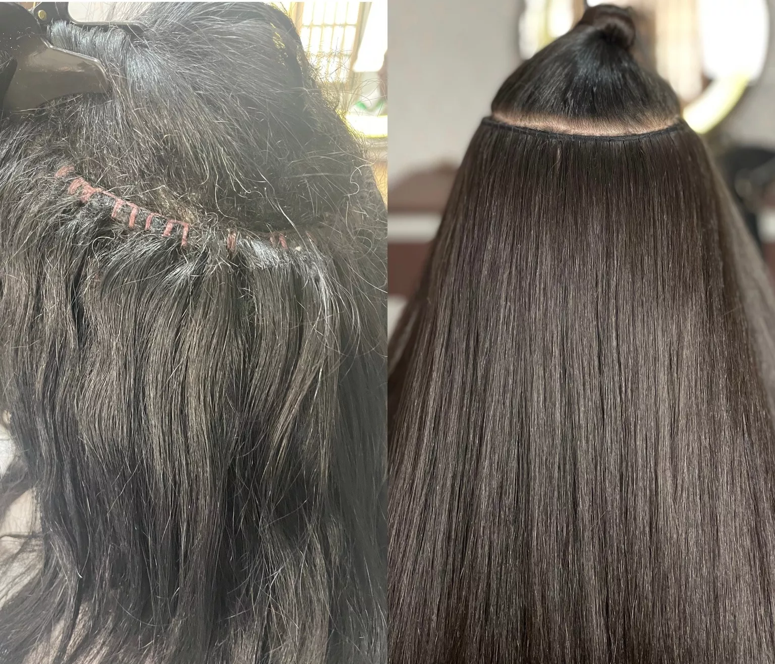 Antes e depois Técnica Ultra Fina