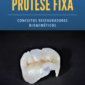Imagem de capa para o Ebook O novo olhar da Prótese Fixa: Conceitos Restauradores Biomiméticos.
