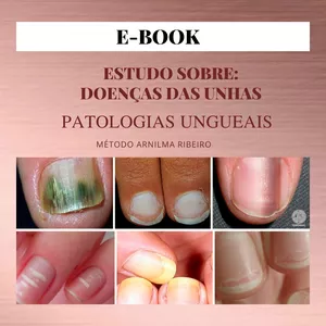 Imagem de capa para o Ebook DOENÇAS DAS UNHAS E PATOLOGIAS UNGUEAIS