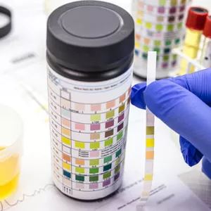 Imagem de capa para o Curso online Curso em Urinálise: Da sedimentoscopia ao laudo