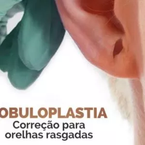 Imagem de capa para o Curso online Lobuloplastia não Cirúrgica- A solução para Orelha Rasgada 