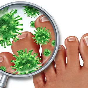 Cover image for Ebook Overcoming Onychomycosis