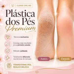 Imagem do curso Plástica dos Pés Premium