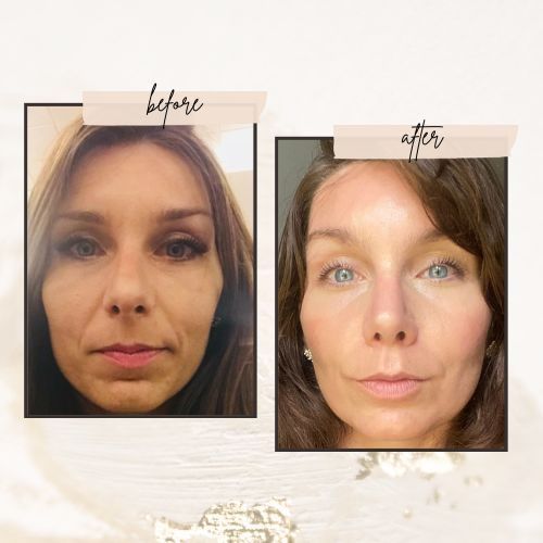 GINÁSTICA FACIAL FACIALFITPRO AULAS COMPLETAS  — imagem 3