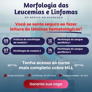 Imagem do curso Morfologia das Leucemias e Linfomas: Do básico ao avançado