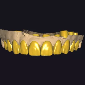 Imagem do curso Desenhando Sorriso (Técnica - Mockup Shell)