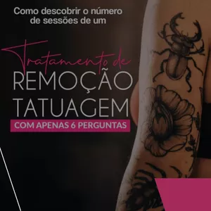 Imagem de capa para o Ebook COMO DESCOBRIR O NUMERO DE SESSÕES DE UM TRATAMENTO DE REMOÇÃO DE TATUAGEM COM APENAS 6 PERGUNTAS?