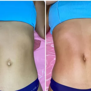 Imagem de capa para o Curso online Massagem modeladora 