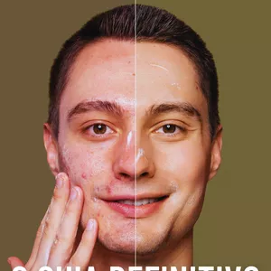 Imagem de capa para o Ebook O Guia Definitivo para Dizer Adeus à Acne(espinha)