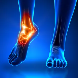 Imagen de portada para Curso online La Guía Completa de Ejercicio Físico para el Dolor Neuropático