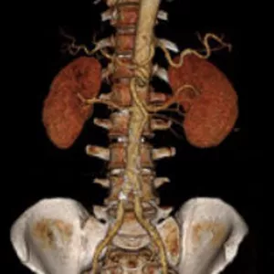 Imagem de capa para o Curso online Curso de AngioTomografia 