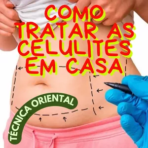 Imagem de capa para o Curso online O fim das celulites em suas mãos