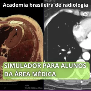 Imagem do curso Simulador de anatomia - TC, RM, Raio X, Ultrassom e 3D