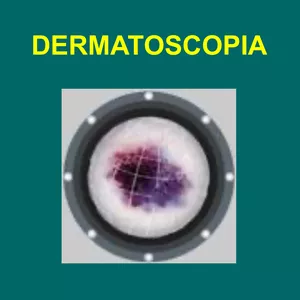 Imagem de capa para o Ebook Conceitos Básicos Dermatoscopia