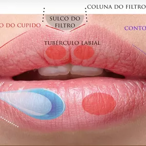 Imagen de portada para Curso online RELLENO DE LABIOS
