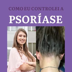 Imagem de capa para o Ebook Como eu controlei a Psoríase