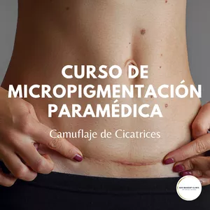 Imagen de portada para Curso online Curso de Micropigmentación Paramédica - Camuflaje de Cicatrices