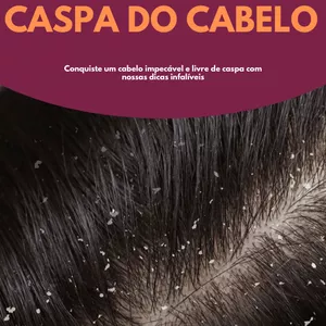 Imagem de capa para o Ebook Como eliminar caspa do cabelo