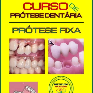 Imagem de capa para o Curso online Curso de Prótese Dentária Fixa