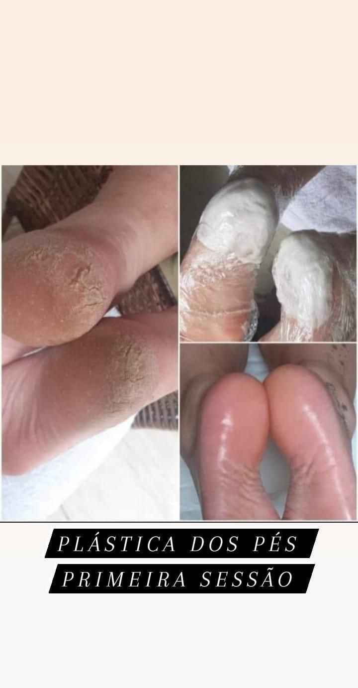 Imagem do curso Plastica dos Pés