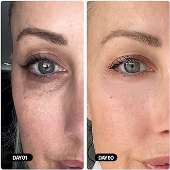 Imagem de Curso clareamento de olheiras  criado por Tavarest Academy na hotmart