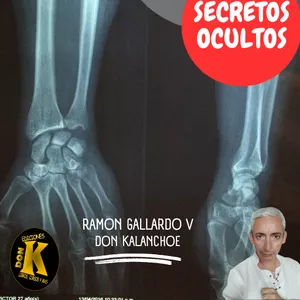 Imagen de portada para Ebook PROTEGE TUS HUESOS - SECRETOS OCULTOS