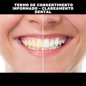 Imagem de capa para o Curso online Termo de Consentimento Informado - Clareamento Dental