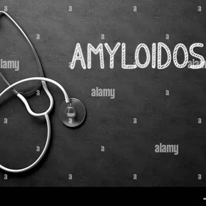 Imagem de capa para o Ebook Amiloidosis: Da Ciência à Esperança 