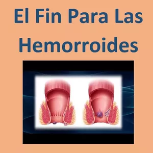 Imagem principal do produto El Fin de las Hemorroides