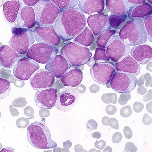 Cover image for Online course Bone marrow examination, hematology course