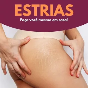 Imagem de capa para o Ebook 05 Remédios Caseiro Contra Estrias — Faça Você Mesmo em Casa