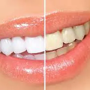 Imagem de capa para o Ebook 3 Formas de Clarear os Dentes em casa Simples e Fácil