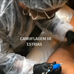 Imagem de capa para o Ebook Camuflagem de Estrias