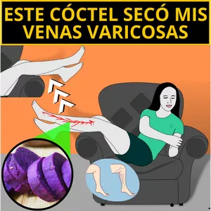 Imagen de portada para Ebook Protocolo/Guía Cero Venas Varicosas