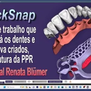 Imagem de capa para o Curso online PPR DIGITAL QUICKSNAP RIJEKA 3.1 EXOCAD - DENTES, GENGIVA E ESTRUTURA