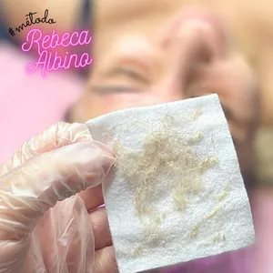 Imagem do curso Dermaplaning & Hidra Gloss